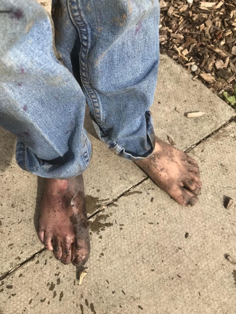 muddy childs feet